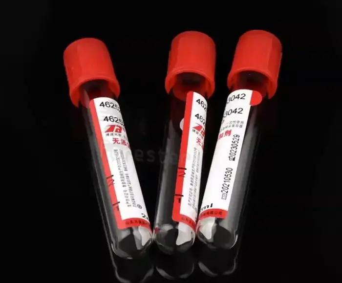 100 pièces collecte de sang sous vide vétérinaire sans additifs Tube PRF consommables de laboratoire 5 ml 10 ml
