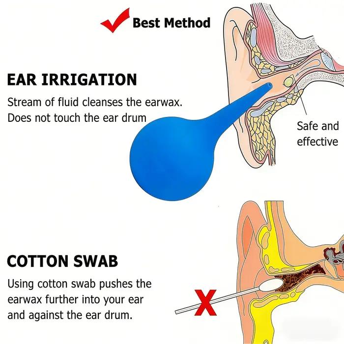5 kits de lavage auriculaire pour éliminer le cérumen et nettoyer les oreilles
