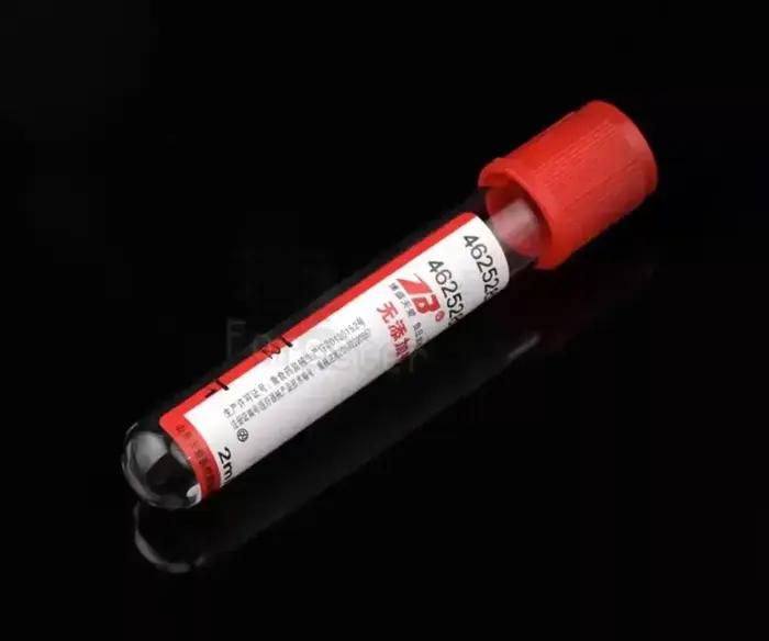 100 pièces collecte de sang sous vide vétérinaire sans additifs Tube PRF consommables de laboratoire 5 ml 10 ml